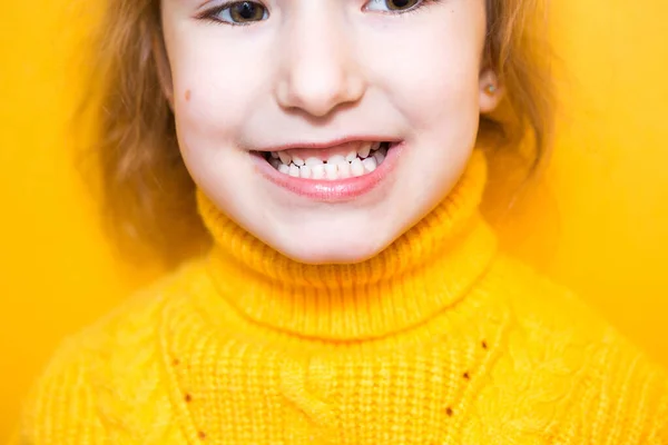 Kız dişlerini gösteriyor. Patolojik ısırık, malocclusion, overbite. Pediatrik dişçilik ve periodontikler, ısırık düzeltmesi. Sağlık ve diş bakımı, bakımı, bebek dişleri. Üst çene sakıza dayanır.