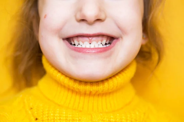 Mädchen Zeigt Ihre Zähne Pathologischer Biss Malokklusion Überbiss Kinderzahnheilkunde Und — Stockfoto