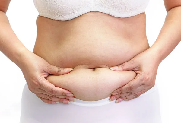 Mulher medindo sua gordura da barriga com as mãos de perto — Fotografia de Stock