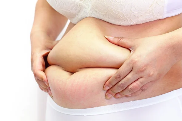 Mulher medindo sua gordura da barriga com as mãos de perto — Fotografia de Stock