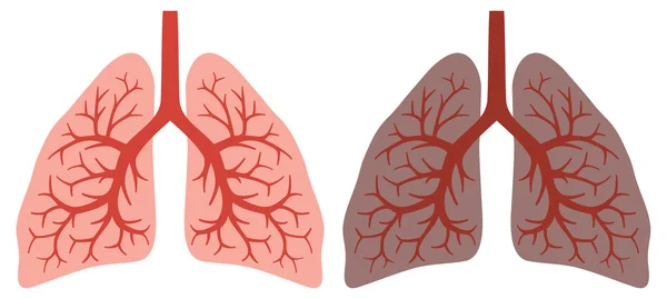 Sağlıklı akciğer ve sigara içenlerin akciğer — Stok Vektör