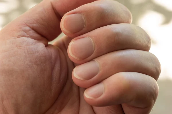 Gepflegte Kaukasische Männliche Fingernägel Makro Nahaufnahme Schuss Flache Schärfentiefe — Stockfoto