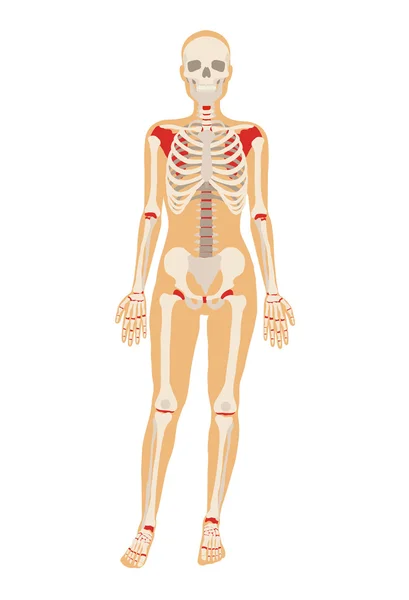 Woman skeleton. Vector flat illustration — Stock Illustration Woman skeleton. Vector flat illustration Stock Illustration