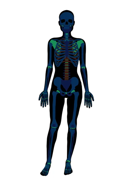 Szkielet x-ray kobieta. Płaskie ilustracji wektorowych — Wektor stockowy