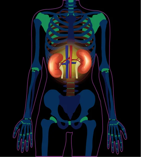 Vector x ray kidneys infographics banner illustration — Stock Vector