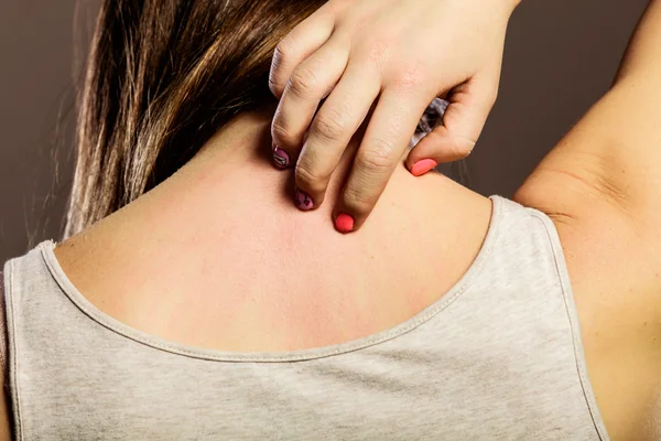 Woman scratching her back closeup — Stock Photo, Image