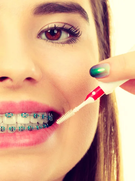 Dentysta Ortodonta Młoda Kobieta Czyści Myje Zęby Niebieskimi Szelkami Pomocą — Zdjęcie stockowe