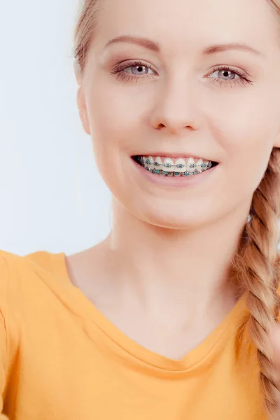 Tandarts Orthodontist Concept Vrouw Glimlach Tonen Haar Witte Tanden Met — Stockfoto