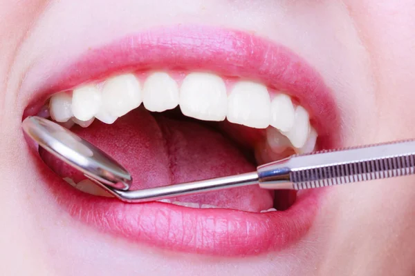 Dental Care Closeup Young Female Having Her Teeth Examinated Healthy — Stock Photo, Image