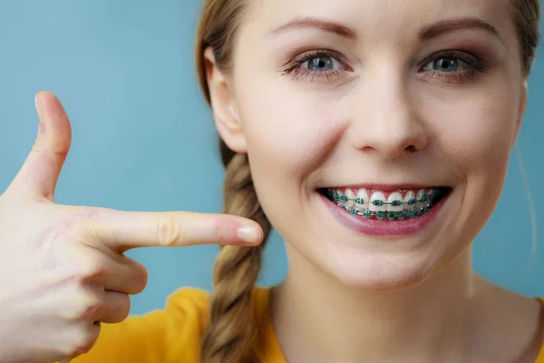 Dentist Orthodontist Concept Young Woman Teen Girl Smiling Pointing Fingers — Stock Photo, Image