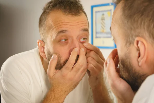 Uomo Adulto Che Indaga Sulle Rughe Brufoli Sul Viso Ragazzo — Foto Stock