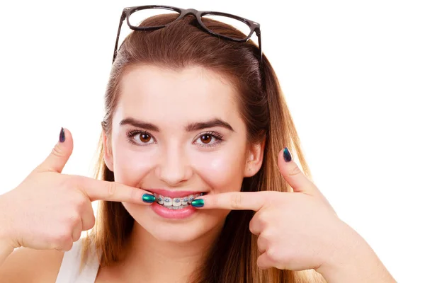 Concetto Dentista Ortodontista Donna Sorriso Mostrando Suoi Denti Bianchi Con — Foto Stock