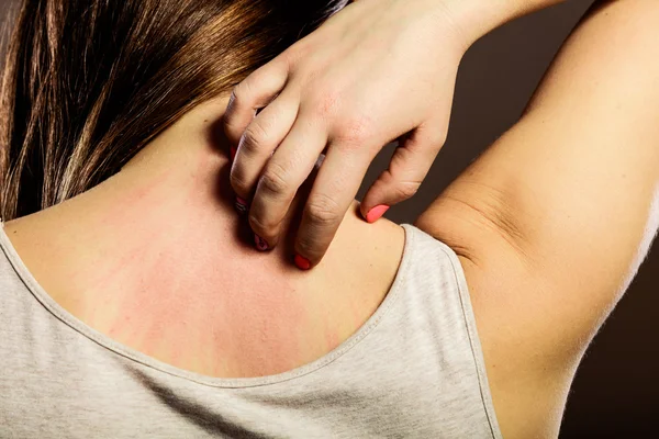 Woman scratching her back — Stock Photo, Image