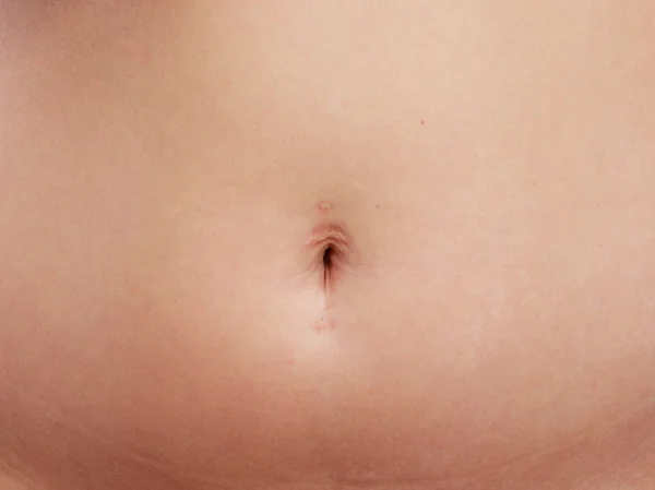 Belly with piercing scar — Stock Photo, Image