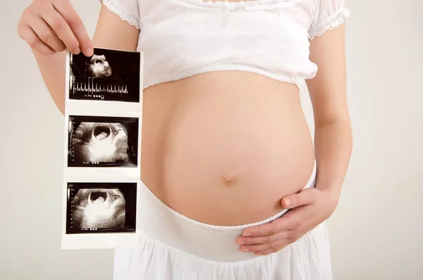 Close up on pregnant belly with baby's ultrasound. — Stock Photo, Image