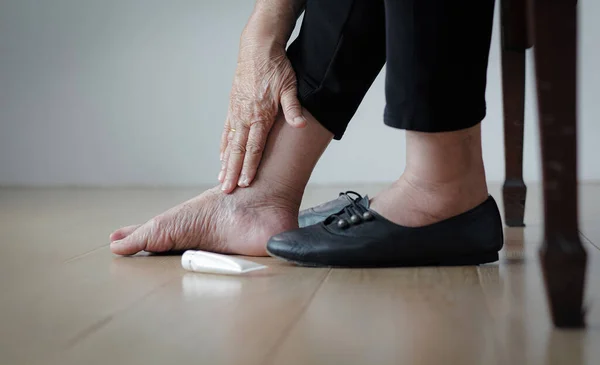 Oudere Vrouw Zet Crème Gezwollen Voeten Voor Het Aantrekken Van — Stockfoto