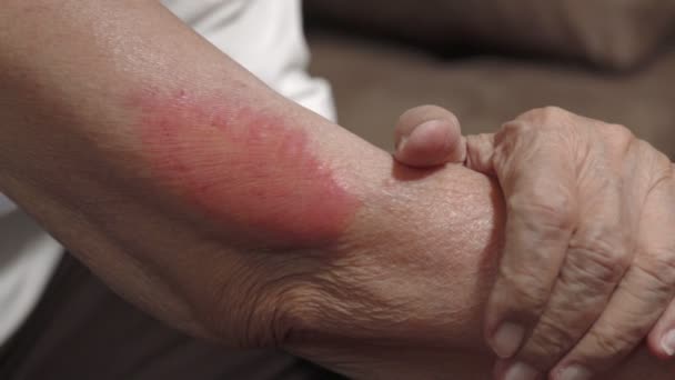 Vacuna Covid Síntomas Alergias Ancianos Después Vacunación — Vídeo de stock