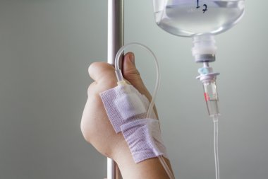 serum fizyolojik Intravenous (IV tarafından şişmiş el).