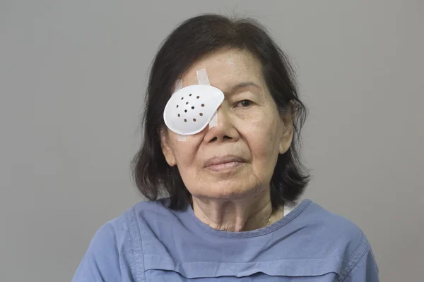 Eye shield covering after cataract surgery. — Stock Photo, Image