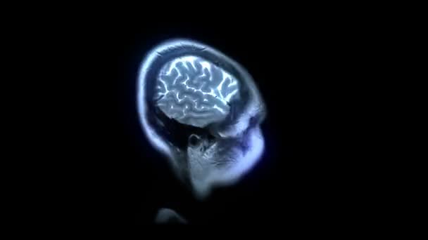 Resonancia magnética cerebral — Vídeos de Stock