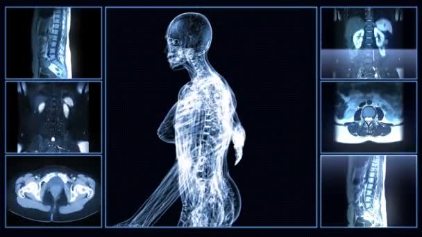 Escaneo por resonancia magnética del cuerpo femenino — Vídeo de stock