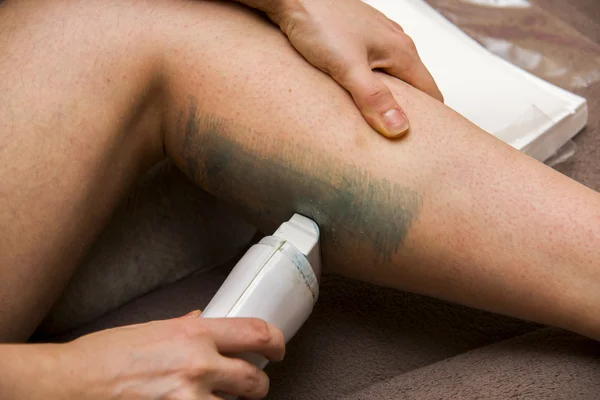 Amateur woman getting legs waxed for hair removal in home — Stock Photo, Image