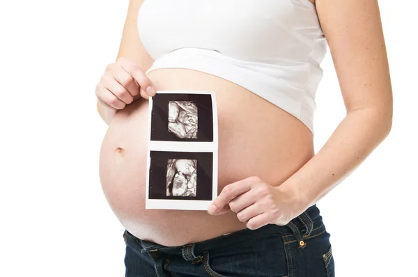 Pregnant woman showing ultrasonography picture — Stock Photo, Image