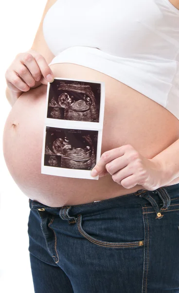 Pregnant woman showing ultrasound picture of her baby — Stock Photo, Image
