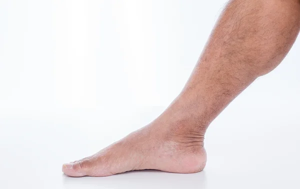 Man foot on white background — Stock Photo, Image