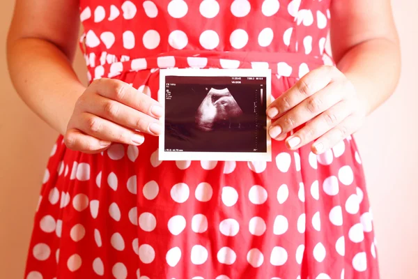 Крупним планом вагітна жінка проводить ультразвукове сканування Стокове Зображення