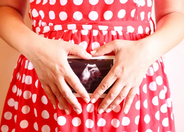 Primer plano de la mujer embarazada sosteniendo ultrasonido Scan Fotos De Stock Sin Royalties Gratis