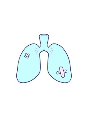 karikatürlerin radyoaktif ışıldayan animasyonu tamir edilmiş akciğerler