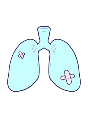 Çizgi filmin hareketli animasyonu tamir edilmiş akciğerler.