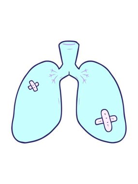 Çizgi filmin titreşimli animasyonu tamir edilmiş akciğerler.