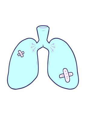 Çizgi film canlandırmasını salla ve durdur tamir edilmiş akciğerleri.