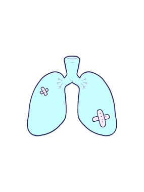 Çizgi film tamir edilen ciğerlerin yıldız patlaması etkisi animasyonu