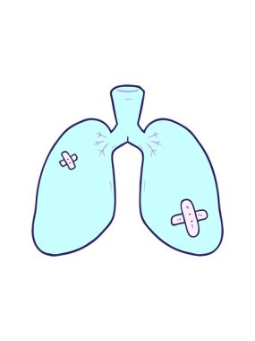 Çizgi filmin dönen hareketli animasyonu tamir edilmiş akciğerler.