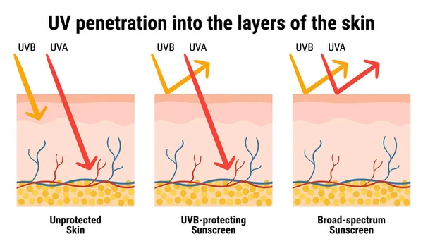Derinin katmanlarında ultraviyole ışınlar var. UVA ve UVB ışınlarına karşı güneş kremi koruması bilgisi. Deri anatomisi. Geniş spektrumlu güneş kremi. El çizimi organik vektör çizimi. 