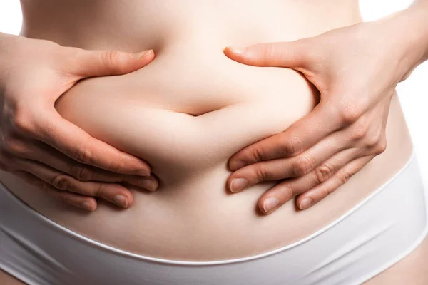 A menina mostra que há um pouco de gordura em sua barriga — Fotografia de Stock