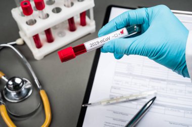 Bir doktor yeni bir Coronavirus 2019 nCoV kan testi için test tüpü tutuyor. Laboratuvar işyeri
