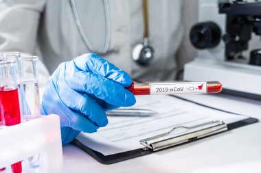 Bir doktor elinde, Çin 'den gelen 2019-nCoV Coronavirüs için pozitif kan testi yapılan bir test tüpü tutuyor..