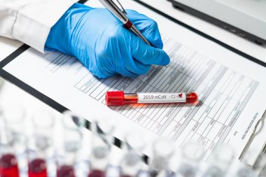 Hasta verilerinin kaydedilmesi için gerekli forma karşı üzerinde yeni bir Coronavirus 2019-nCoV türü olan bir kan testi tüpü. Doktorların işyeri