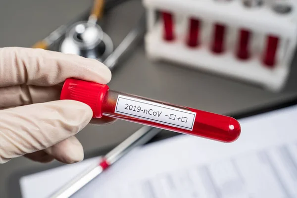 Doktor içinde kan olan bir test tüpü tutuyor. Yeni bir koronovirüs ile enfeksiyon testi. Çin 'in yeni virüsü 2019-nCoV