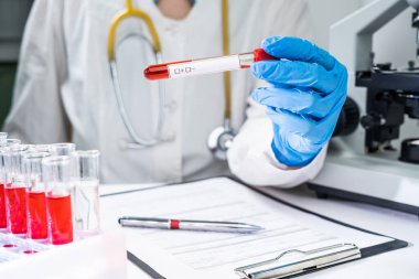 Laboratuvar teknisyeni 2019-nCoV COVID virüsü için test tüpü tutuyor..