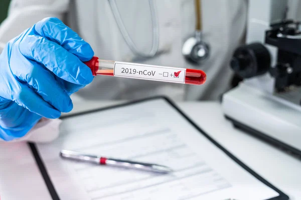 Blood test tube in doctor hand, Mers-CoV Coronavirus test Positive label in hospital blood test tube for analysis. 2019-nCoV virus infection originating in Wuhan, China