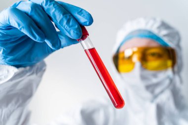 Kan testinin sonucunu gösteren mavi ameliyat eldivenli mikrobiyolog ya da tıp çalışanı elin hızla yayılan Coronavirus COVID-19 'a yakın olduğu tespit edildi.