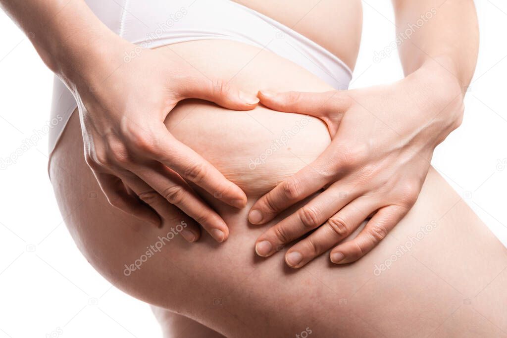 punch oversized female buttocks with cellulite on white background