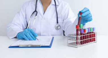 Bilim insanları veya hekimler, yeni bir virüs türü, kan testi tüpleri, aşı araştırma ve bilim konseptine karşı aşı hazırlamak için tüp içinde kan örneğini analiz ederler..