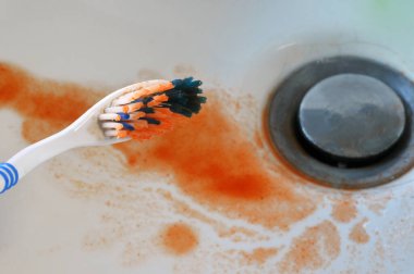 Diş fırçasında ve lavaboda kan olan diş kanaması kavramı.