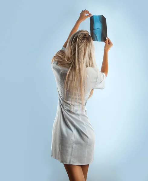 Mujer rubia mirando la foto de rayos X desde la parte trasera — Foto de Stock